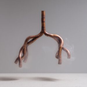 Lung (Digital Image)