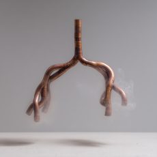 Lung (Digital Image)